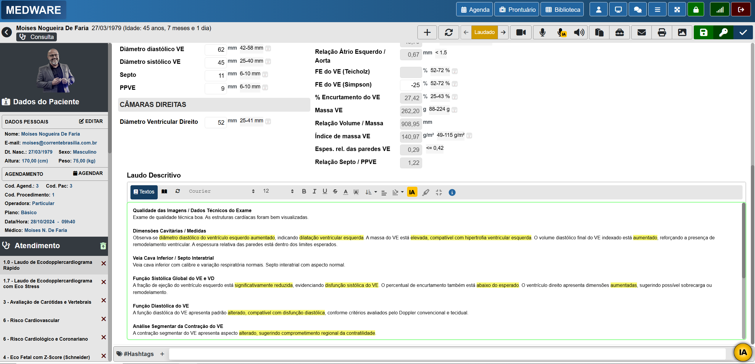 Laudo de Ecocardiografia com IA: mais agilidade e precisão na rotina médica