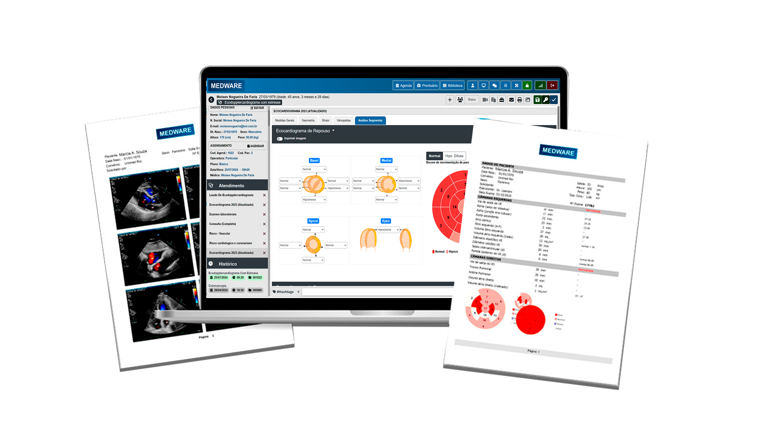 Sistema para laudo de ecocardiograma: como escolher o melhor software para ecocardiografia